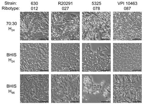 Isolating and Purifying Clostridium difficile Spores 